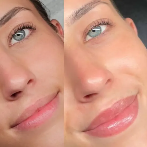 Lips before and healed soft barely-there pink lip blush
