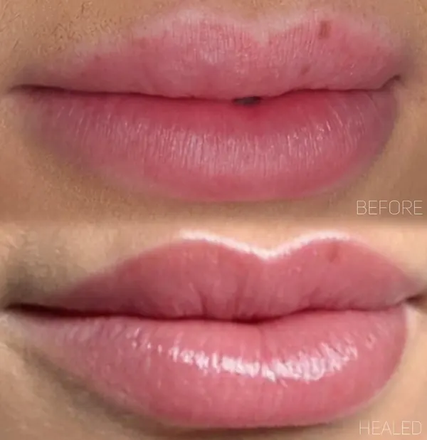 Lips before, above, and healed lip blush after one session, below