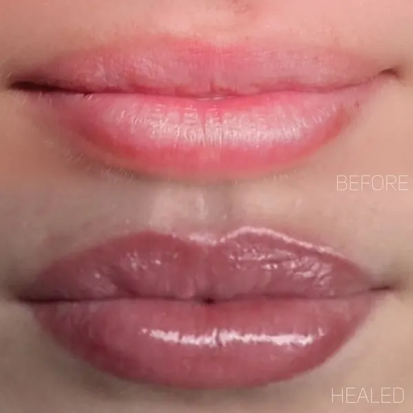 Lips before, above, and glossy rosy healed lip blush, below