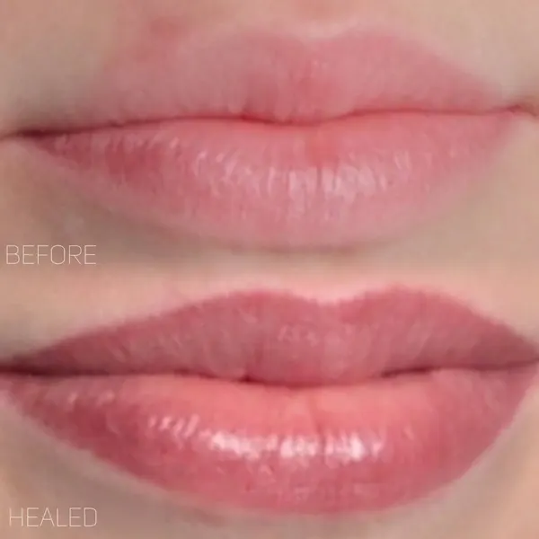 Lips before above and healed lip blush below, labelled, one session