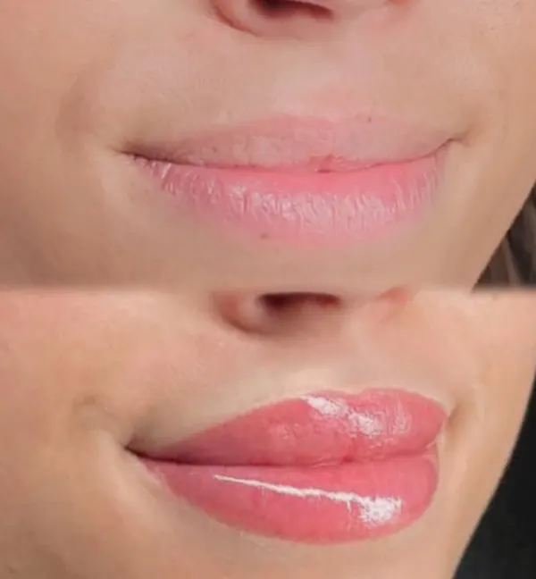 Lips before and freshly done ombré blush lips