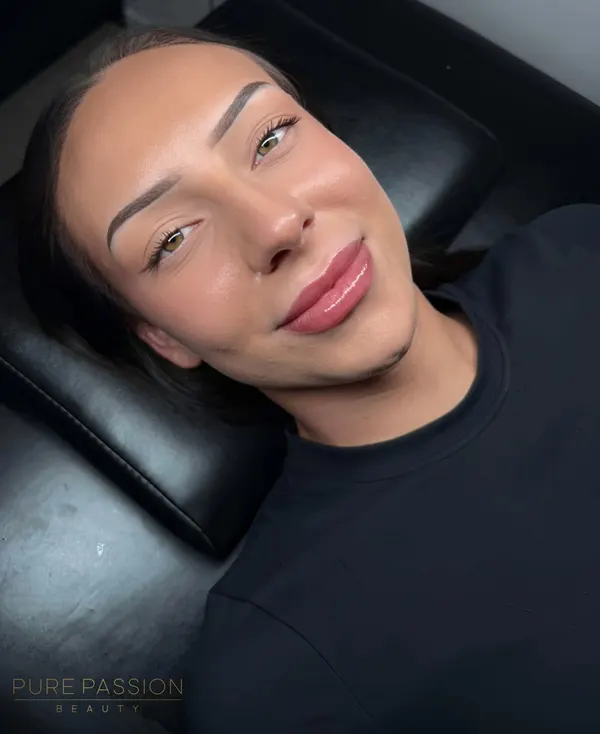 Client with healed lip blush over lip filler