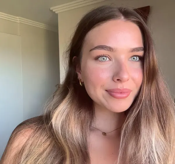Client in natural light with healed pink lip blush and no lipstick